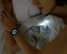 Can wearable devices detect heart problems early? doctor broke real data